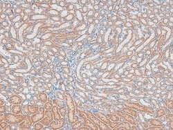 Invitrogen Phospho-DNA ligase IV (Thr650) Polyclonal Antibody 100 &mu;L;