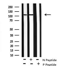 Invitrogen Phospho-KIF1C (Ser1092) Polyclonal Antibody 100 &mu;L; Unconjugated:Antibodies,