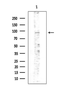 Invitrogen Phospho-PKD2 (Ser812) Polyclonal Antibody 100 &mu;L; Unconjugated:Antibodies,