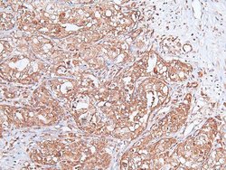 Invitrogen Phospho-VAMP4 (Ser30) Polyclonal Antibody 100 &mu;L; Unconjugated:Antibodies,