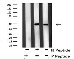 Invitrogen Phospho-ATF4 (Ser219) Polyclonal Antibody 100 &mu;L | Buy Online | Invitrogen&trade; | Fisher Scientific