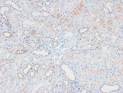 Invitrogen Phospho-ATM (Ser1893) Polyclonal Antibody 100 &mu;L; Unconjugated:Antibodies,