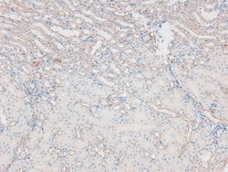 Invitrogen Phospho-ATM (Ser1893) Polyclonal Antibody 100 &mu;L; Unconjugated:Antibodies,