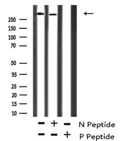 Invitrogen Phospho-ATM (Ser1893) Polyclonal Antibody 100 &mu;L; Unconjugated:Antibodies,