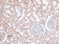 Invitrogen Phospho-EGFR (Tyr998) Polyclonal Antibody 100 &mu;L; Unconjugated:Antibodies,
