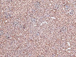 Invitrogen Phospho-EGFR (Tyr998) Polyclonal Antibody 100 &mu;L; Unconjugated:Antibodies,