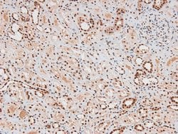 Invitrogen Phospho-FAK (Tyr577) Polyclonal Antibody 100 &mu;L; Unconjugated:Antibodies,