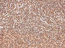 Invitrogen Phospho-FAK (Tyr577) Polyclonal Antibody 100 &mu;L; Unconjugated:Antibodies,