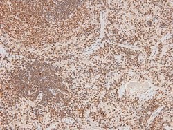 Invitrogen Phospho-FAK (Tyr577) Polyclonal Antibody 100 &mu;L; Unconjugated:Antibodies,