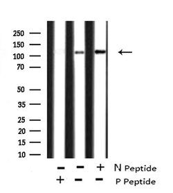 Invitrogen Phospho-FAK (Tyr577) Polyclonal Antibody 100 &mu;L; Unconjugated:Antibodies,
