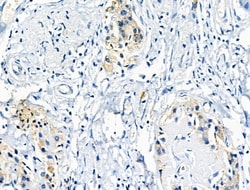 Invitrogen Phospho-IGF1R (Tyr980) Polyclonal Antibody 100 &mu;L; Unconjugated:Antibodies,