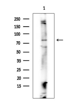 Invitrogen Phospho-IGF1R (Tyr980) Polyclonal Antibody 100 &mu;L; Unconjugated:Antibodies,