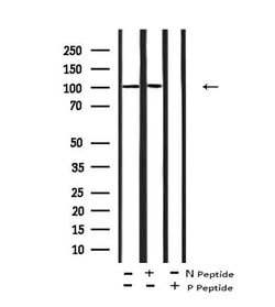 Invitrogen Phospho-STAT2 (Tyr631) Polyclonal Antibody 100 &mu;L | Buy Online | Invitrogen&trade; | Fisher Scientific