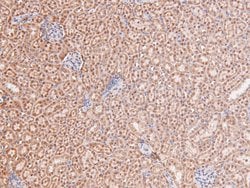 Invitrogen Phospho-STAT4 (Ser721) Polyclonal Antibody 100 &mu;L; Unconjugated:Antibodies,