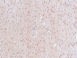 Invitrogen Phospho-STAT4 (Ser721) Polyclonal Antibody 100 &mu;L; Unconjugated:Antibodies,