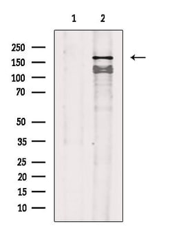 Invitrogen Phospho-VEGF Receptor 1 (Tyr1242) Polyclonal Antibody 100 &mu;L;