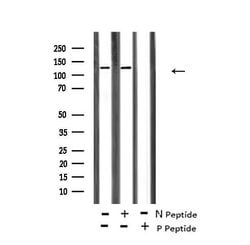 Invitrogen Phospho-ABL1/ABL2 (Tyr70, Tyr116) Polyclonal Antibody 100 &mu;L;