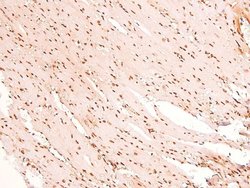 Invitrogen Phospho-CSK (Tyr304) Polyclonal Antibody 100 &mu;L; Unconjugated:Antibodies,