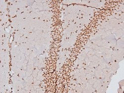 Invitrogen Phospho-CSK (Tyr304) Polyclonal Antibody 100 &mu;L; Unconjugated:Antibodies,