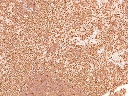 Invitrogen Phospho-CSK (Tyr304) Polyclonal Antibody 100 &mu;L; Unconjugated:Antibodies,