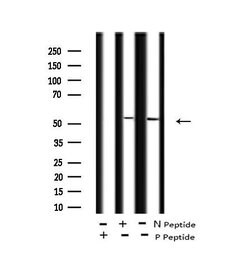 Invitrogen Phospho-CSK (Tyr304) Polyclonal Antibody 100 &mu;L; Unconjugated:Antibodies,