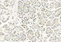 Invitrogen Phospho-DYRK1A/DYRK1B (Tyr321, Tyr273) Polyclonal Antibody 100