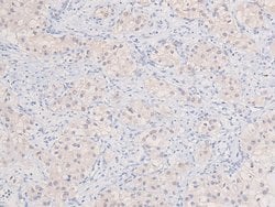 Invitrogen Phospho-DYRK1A/DYRK1B (Tyr321, Tyr273) Polyclonal Antibody 100
