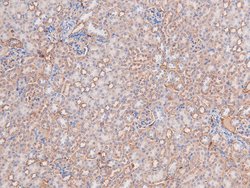 Invitrogen Phospho-DYRK1A/DYRK1B (Tyr321, Tyr273) Polyclonal Antibody 100