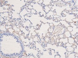 Invitrogen Phospho-DYRK1A/DYRK1B (Tyr321, Tyr273) Polyclonal Antibody 100