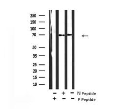 Invitrogen Phospho-DYRK1A/DYRK1B (Tyr321, Tyr273) Polyclonal Antibody 100