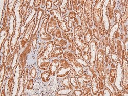Invitrogen Phospho-EphA8 (Tyr839) Polyclonal Antibody 100 &mu;L; Unconjugated:Antibodies,