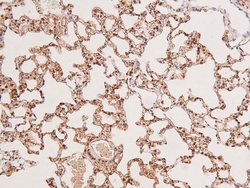 Invitrogen Phospho-EphA8 (Tyr839) Polyclonal Antibody 100 &mu;L; Unconjugated:Antibodies,
