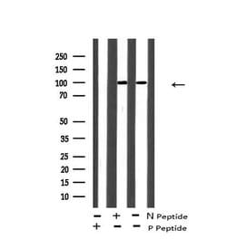 Invitrogen Phospho-EphA8 (Tyr839) Polyclonal Antibody 100 &mu;L; Unconjugated:Antibodies,