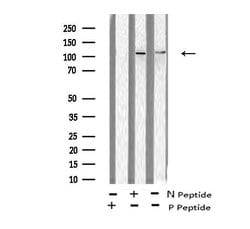 Invitrogen Phospho-EphB1/EphB2/EphB3/EphB4 (Tyr600, Tyr602, Tyr614, Tyr596)