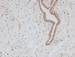 Invitrogen Phospho-FER (Tyr714) Polyclonal Antibody 100 &mu;L | Buy Online | Invitrogen&trade; | Fisher Scientific