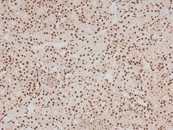 Invitrogen Phospho-FER (Tyr714) Polyclonal Antibody 100 &mu;L | Buy Online | Invitrogen&trade; | Fisher Scientific
