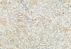 Invitrogen Phospho-FGFR2 (Tyr769) Polyclonal Antibody 100 &mu;L; Unconjugated:Antibodies,