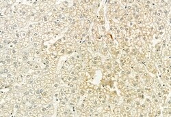 Invitrogen Phospho-FGFR2 (Tyr769) Polyclonal Antibody 100 &mu;L; Unconjugated:Antibodies,