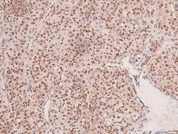 Invitrogen Phospho-FGFR2 (Tyr769) Polyclonal Antibody 100 &mu;L; Unconjugated:Antibodies,