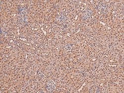 Invitrogen Phospho-FGFR2 (Tyr769) Polyclonal Antibody 100 &mu;L; Unconjugated:Antibodies,