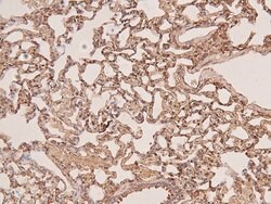 Invitrogen Phospho-FGFR2 (Tyr769) Polyclonal Antibody 100 &mu;L; Unconjugated:Antibodies,