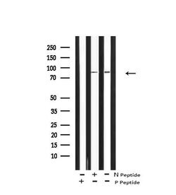 Invitrogen Phospho-FGFR4 (Tyr754) Polyclonal Antibody 100 &mu;L | Buy Online | Invitrogen&trade; | Fisher Scientific