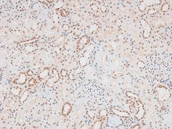 Invitrogen Phospho-FGR (Tyr412) Polyclonal Antibody 100 &mu;L; Unconjugated:Antibodies,