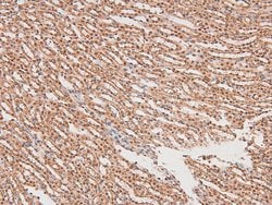 Invitrogen Phospho-FGR (Tyr412) Polyclonal Antibody 100 &mu;L; Unconjugated:Antibodies,