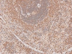 Invitrogen Phospho-FGR (Tyr412) Polyclonal Antibody 100 &mu;L; Unconjugated:Antibodies,