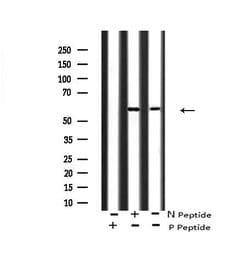 Invitrogen Phospho-FGR (Tyr412) Polyclonal Antibody 100 &mu;L; Unconjugated:Antibodies,
