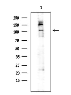 Invitrogen Phospho-FLT3 (Tyr591) Polyclonal Antibody 100 &mu;L; Unconjugated:Antibodies,