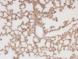 Invitrogen Phospho-FLT3 (Tyr591) Polyclonal Antibody 100 &mu;L; Unconjugated:Antibodies,