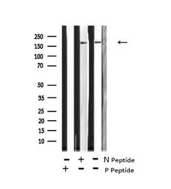 Invitrogen Phospho-GCN2 (Thr899) Polyclonal Antibody 100 &mu;L; Unconjugated:Antibodies,