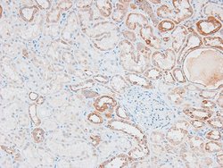 Invitrogen Phospho-IKK epsilon (Ser172) Polyclonal Antibody 100 &mu;L;